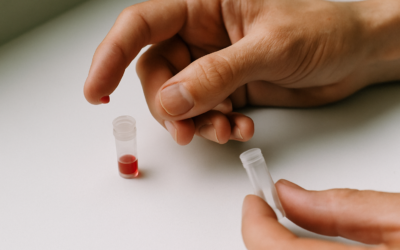 Bloedonderzoek thuis: welke biomarkers zeggen écht iets over je gezondheid?